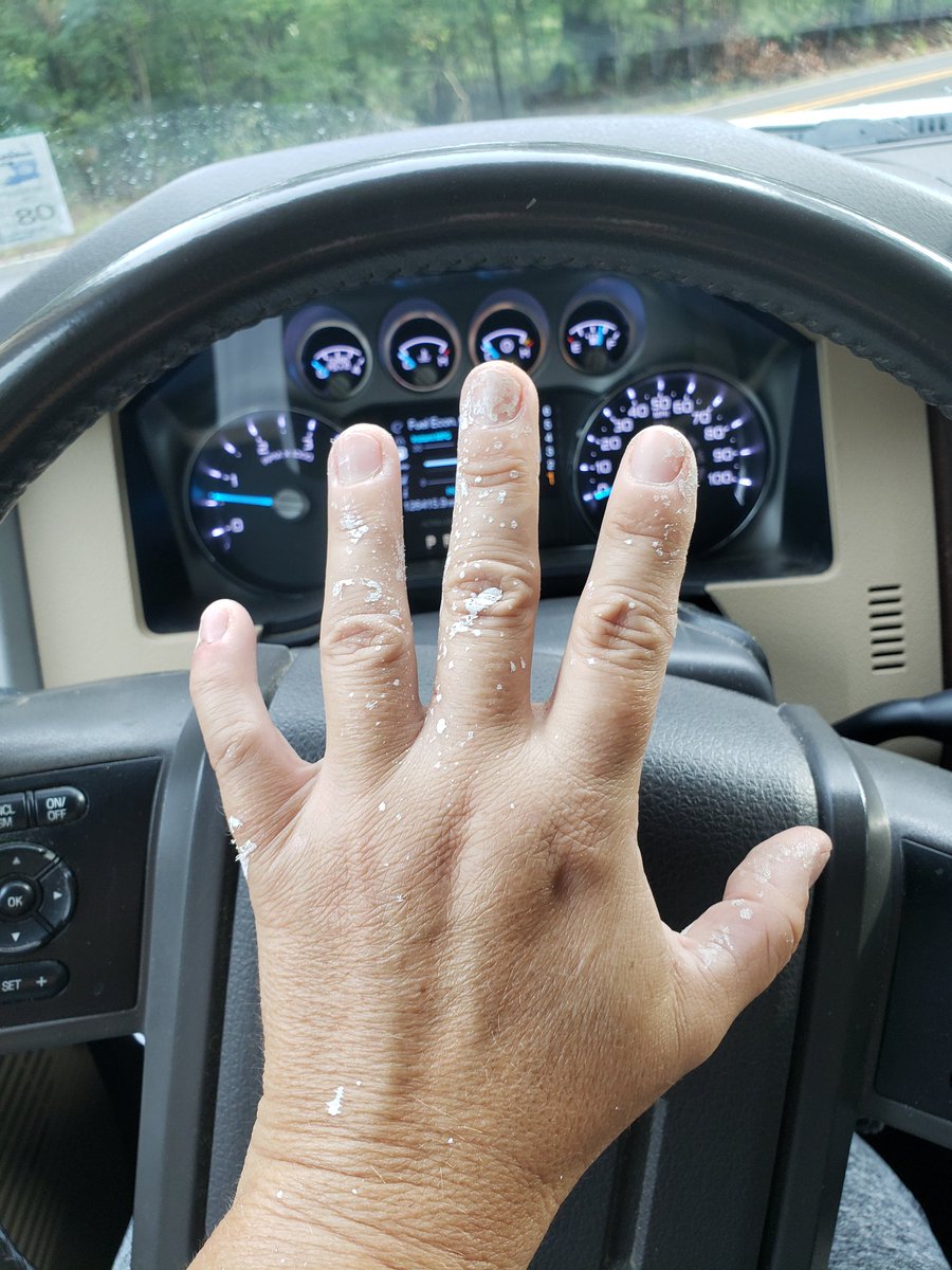 barngrl's tweet image. It was a #FlexSeal job this am