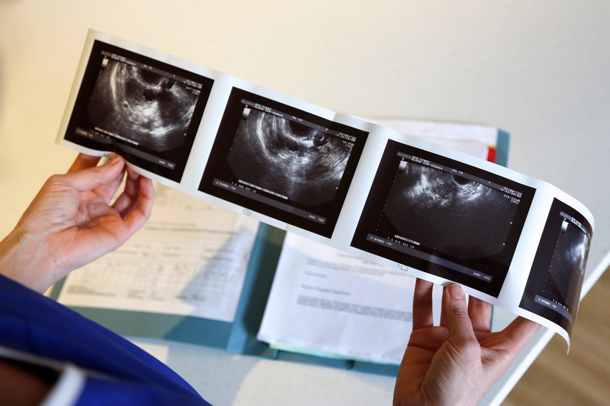 KingsCollegeNHS's tweet photo. Maternity update: For the latest information on partners attending scans, and supporting women during labour and after birth please visit our website https://t.co/7ZHwLtDnot https://t.co/BQC8v0vEzq