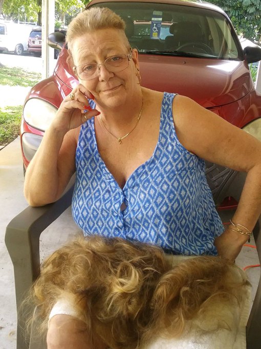 2nd round of Chemo done. Hair was coming out so I took off most of it instead of waiting. #cancersucks<a href="/tag/staypositive"class="tags"><span>#staypositive</span></a><a href="/tag/cancersucks"class="tags"><span>#cancersucks</span></a><a href="/tag/luvmydoctors"class="tags"><span>#luvmydoctors</span></a>