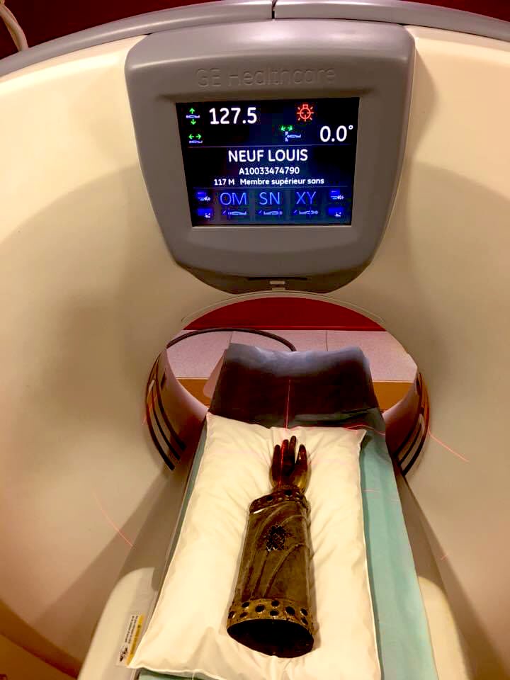 Fondation_AAB's tweet photo. Il y a 3 ans, le bras-reliquaire de Saint-Louis (Prudhomat, Lot) était examiné au scanner :

la médecine au service de l’histoire et de l’histoire de l’art. https://t.co/07TIJKrs2r