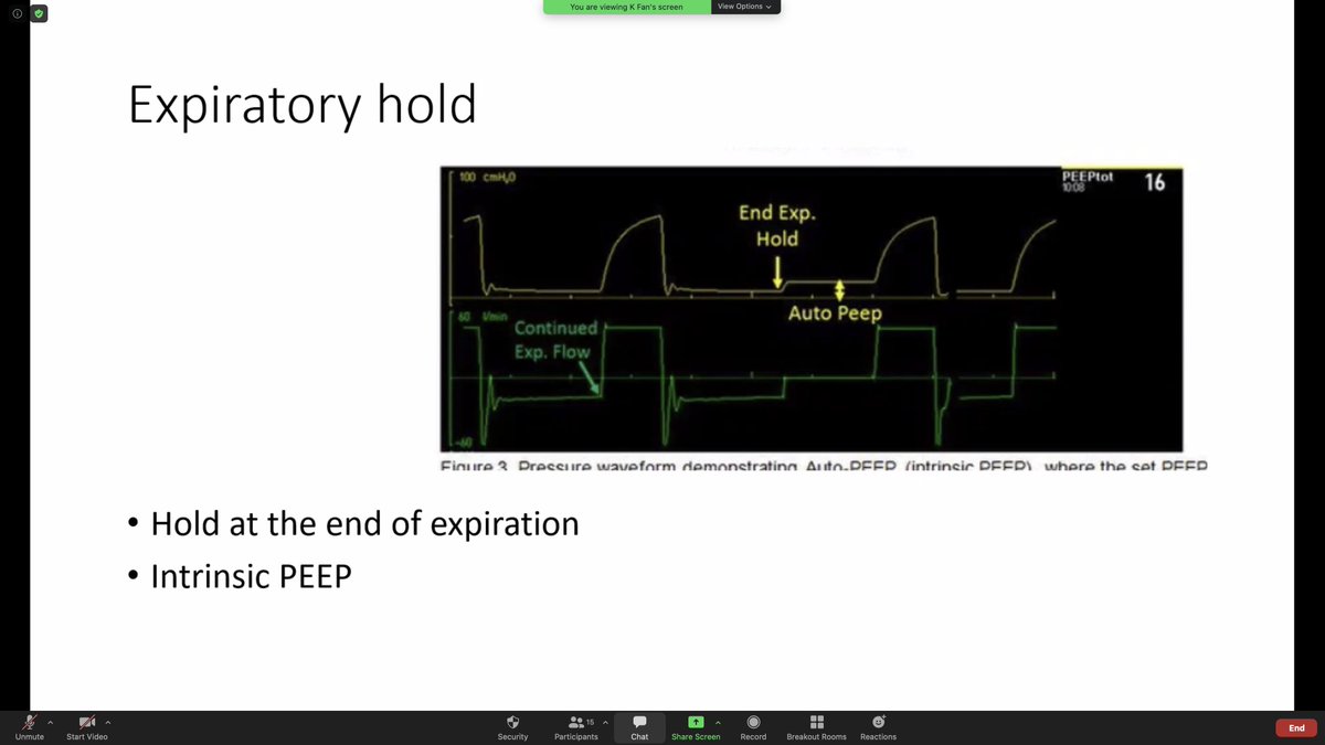 Amazed by the clarity of the #PedsICU fellows' presentations! Here 3rd year CCM fellow Dr. Kim Fan <a href="/KFan_MD/">Kim Fan</a> presents 'Loops and troubleshooting tips for mechanical ventilation'. <a href="/UTHSCPedCritCar/">UTHSC Pediatric Critical Care Medicine</a> <a href="/LeBonheurChild/">Le Bonheur Children's</a> <a href="/StJude/">St. Jude</a>