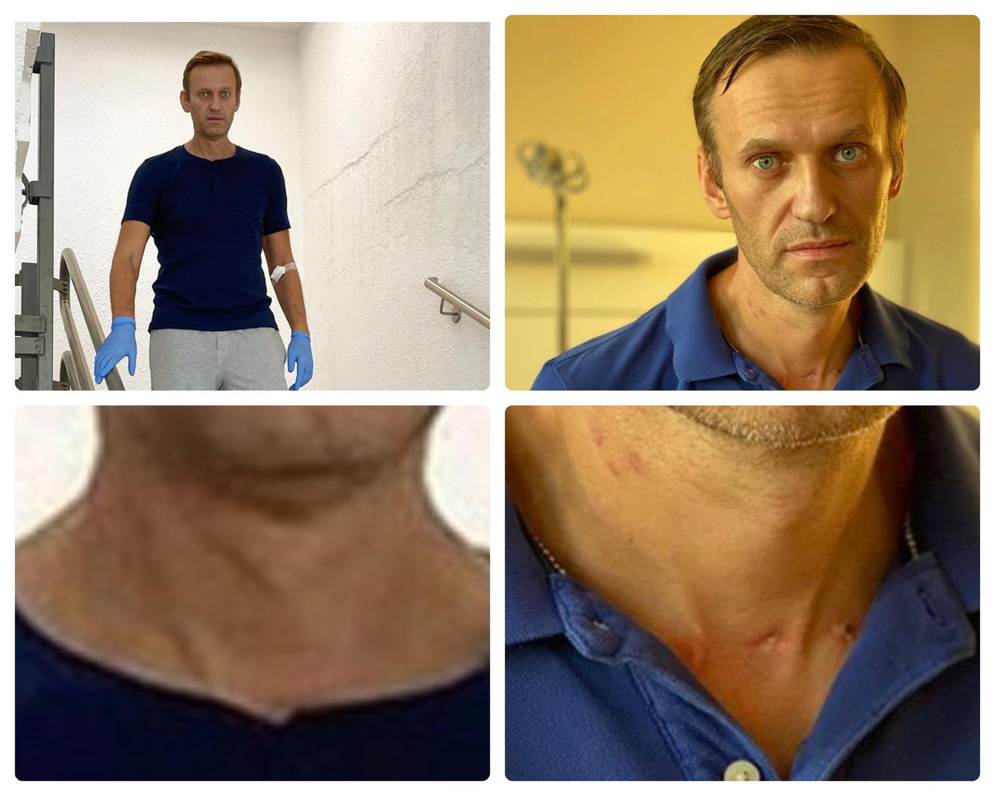 Алексей Навальный худой
