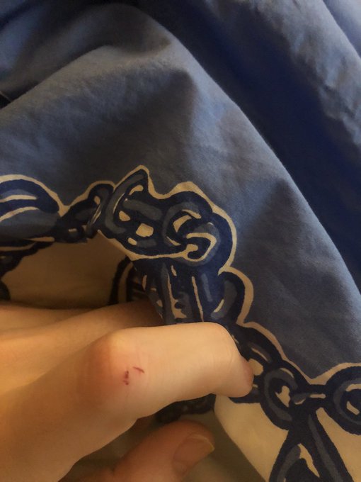 I was playing with @sofia_bun&rsquo;s rabbit, and as she was lunging for a toy, she accidentally bit me. Oh<a class="tags" href="/tag/sofia_bun">@sofia_bun</a><a href="/tag/baddragon"class="tags"><span>#baddragon</span></a>