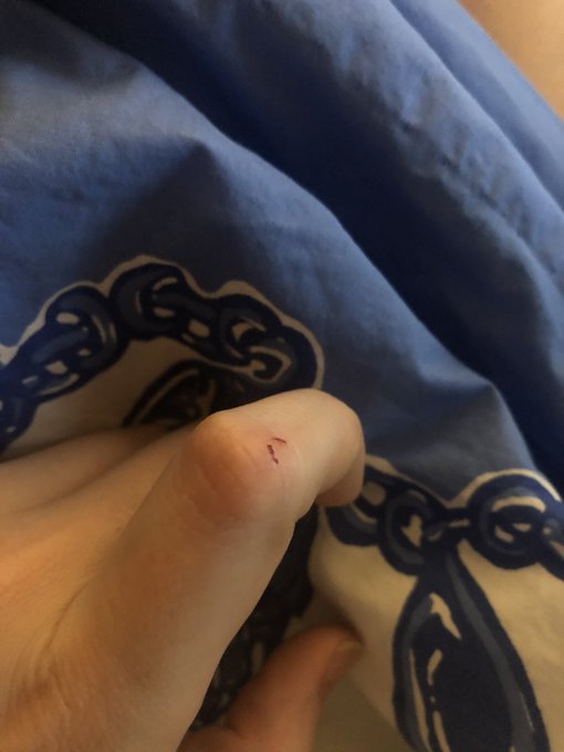 I was playing with @sofia_bun&rsquo;s rabbit, and as she was lunging for a toy, she accidentally bit me. Oh<a class="tags" href="/tag/sofia_bun">@sofia_bun</a><a href="/tag/baddragon"class="tags"><span>#baddragon</span></a>