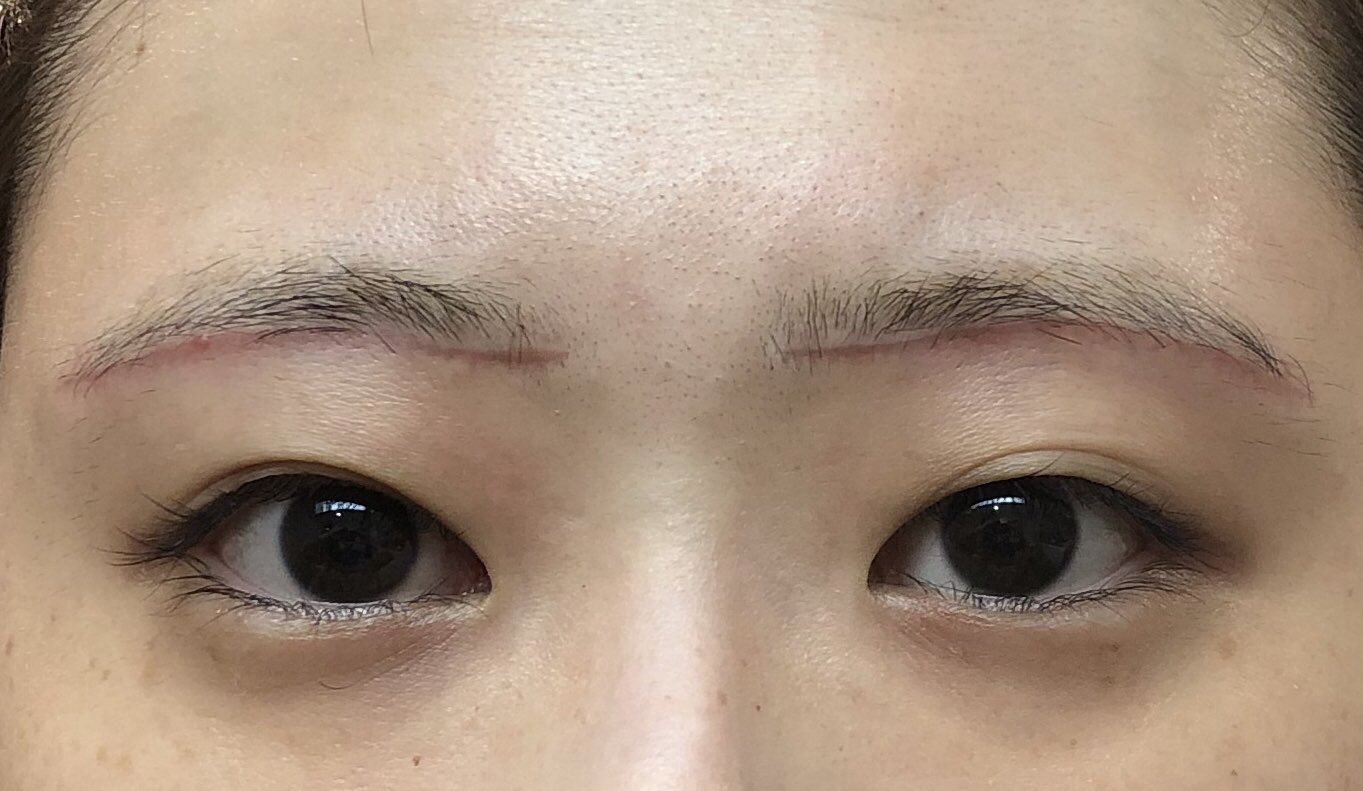 みみまゆ 眉下切開 抜糸後の眉メイクはここにまとめました Twitter