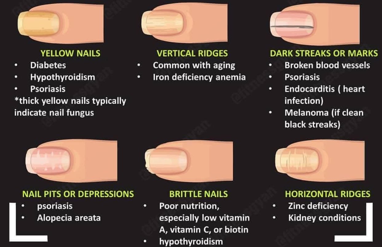 Nail Health Chart: How To Identify Problems