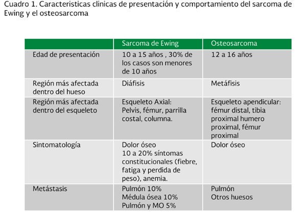 El sarcoma de ewing es curable