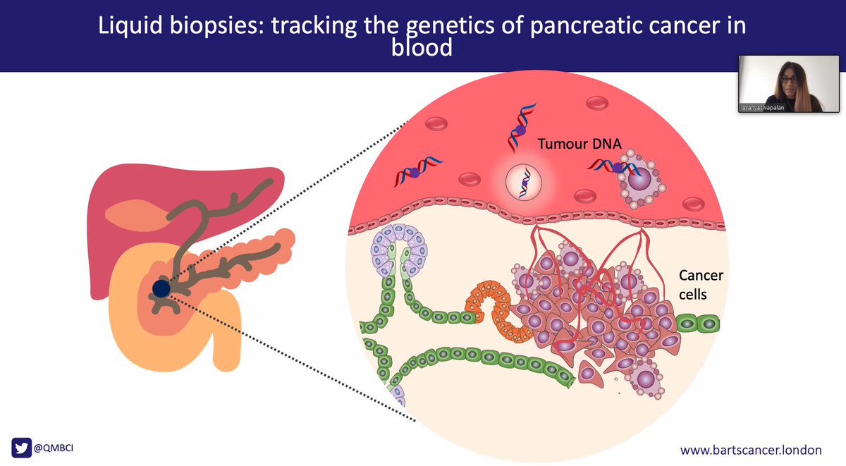 After a great first session of poster presentations at #BCIPhDDay, we are now moving onto the Three Minute Thesis presentations <a href="/BciPhdForum/">BCI PhD Forum</a>. Lavanya is speaking about her project on liquid biopsies for #PancreaticCancer