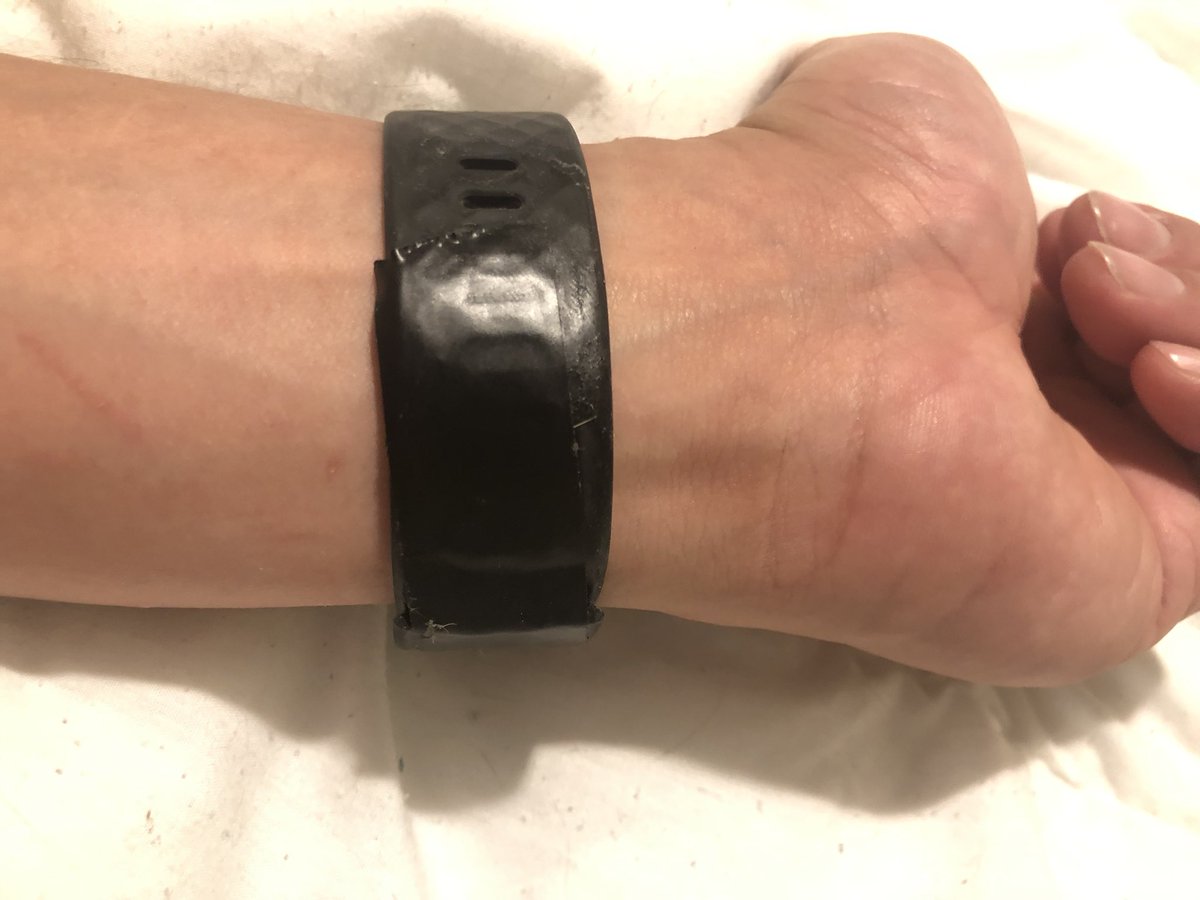 mfuery's tweet photo. Black electrical tape to use my @FitbitSupport Fitbit Charge 3 because they would not help me fix my broken wristband. It can work! For a couple days at least, I hope 🤞 https://t.co/eP170ksNQZ