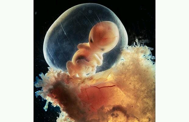 Four weeks. Беременность 7 недель выглядит эмбрион. Эмбрион на 3 неделе беременности фото. Зародыш на 7 неделе беременности. Беременность 6 недель фото эмбриона.