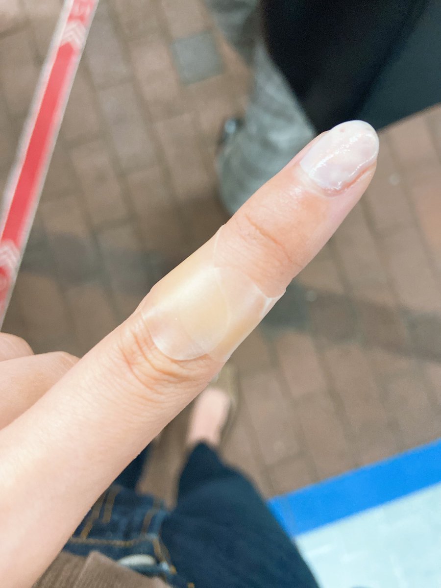 えりあ ハサミで肉見えるまで切った私にキズパワーパッドという高級品を買ってくれる人 ちなみにネイルもしてくれる人