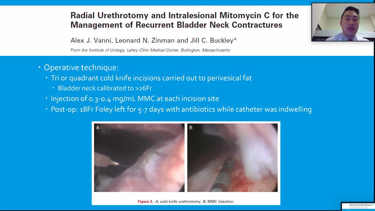 LoyolaUrology's tweet image. Fantastic talks by our Sub-Is @TimothyMHan (MMC use in BNCs) &amp;amp; @hanslovo (Direct-to-Consumer ED Rx Platforms)! 👏💯 Great work this month! We loved having you.