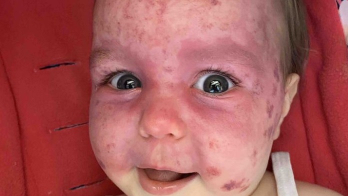 Vengo a pediros ayuda.

Este pequeño angelito es Ariya, sobrina del piloto Kyle Smith, sufre el síndrome de Sturge Weber y necesita varios tratamientos.

Aquí podéis hacer una donación para echarles un cable: gofundme.com/f/247wmz89tc

Y si no, un RT es gratis y ayuda muchísimo.