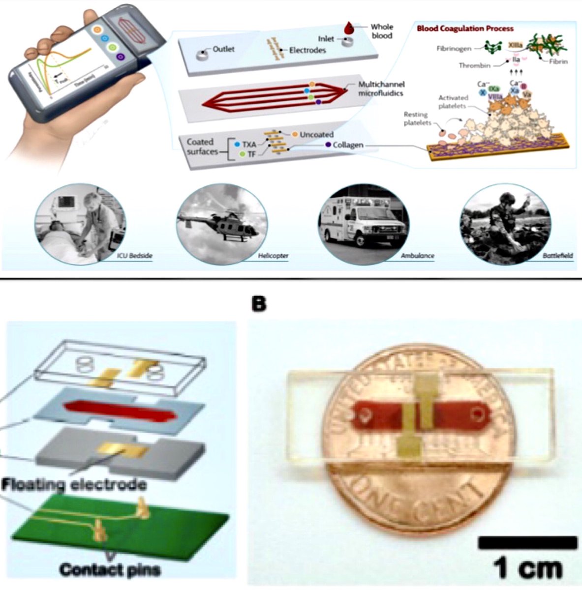Anirban Sen Gupta (@jishnusengupta) on Twitter photo Want to work at the interface of Electrical Engg, Biomaterials & BME?
We <a href="/CWRUBME/">CWRU Biomedical Engineering</a> <a href="/CaseEngineer/">CWRU Engineering</a> are recruiting post-doc researchers on a Coulter & DoD funded project to build surface-engineered electrodes for hand-held dielectric coagulometer to assess trauma coagulopathy. DM me! Want to work at the interface of Electrical Engg, Biomaterials & BME?
We <a href="/CWRUBME/">CWRU Biomedical Engineering</a> <a href="/CaseEngineer/">CWRU Engineering</a> are recruiting post-doc researchers on a Coulter & DoD funded project to build surface-engineered electrodes for hand-held dielectric coagulometer to assess trauma coagulopathy. DM me!