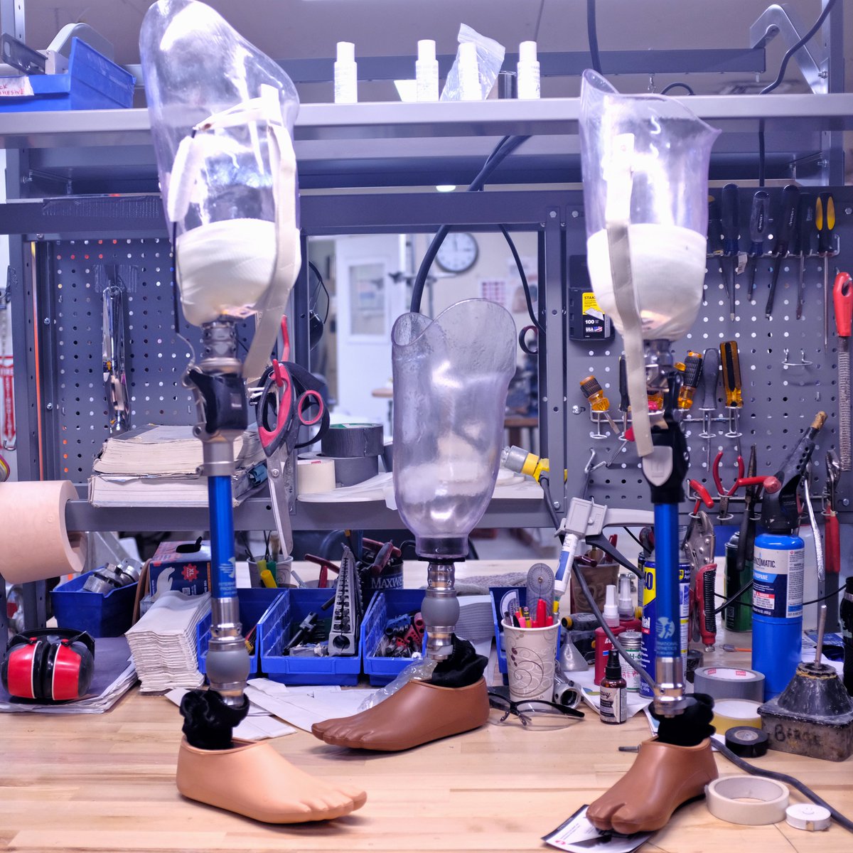 ipolongisland's tweet photo. 2 rights don't make a left!!
2 right above knee prosthesis and 1 left below knee prosthesis with diagnostic sockets ready for fitting. Happy Wednesday
#AboveKnee #BelowKnee #InternationalProstheticsAndOrthotics #Prosthetic #ProstheticLeg https://t.co/5jppQ0njBQ