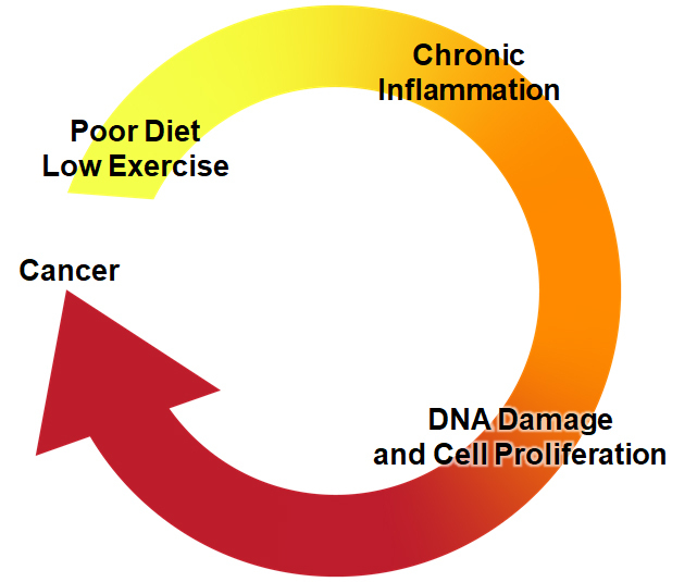 <a href="/EverydayHealth/">Everyday Health</a> <a href="/Abeccarey/">Rebecca Levine</a> A4- Here’s a simple way to think about inflammation and cancer. #ProstateCancerChat (6/10)
