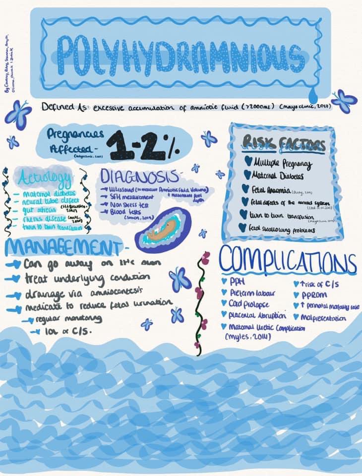 💙 POLYHYDRAMNIOS &amp; OLIGOHYDRAMNIOS 💙

Today the second years had their session on polyhydramnios (excess amniotic fluid) &amp; oligohydramnios (minimal amniotic fluid) in which they split into groups to create powerpoints, posters etc😊