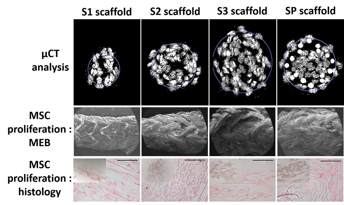 Polymers_MDPI's tweet image. #polymers 
"Characterization of Bone Marrow and Wharton’s Jelly Mesenchymal Stromal #Cells Response on Multilayer Braided Silk and Silk/#PLCL Scaffolds for Ligament Tissue Engineering" 
mdpi.com/2073-4360/12/9…