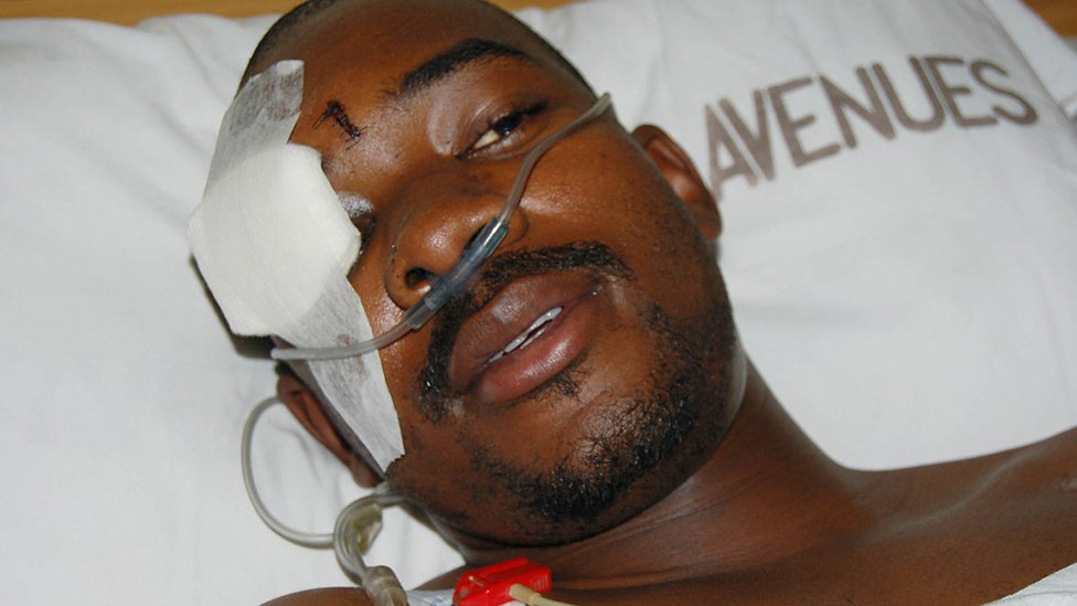 2/7 Nelson Chamisa earned his popularity & ascension to party leadership through hard work, sacrifice & undisputed loyalty to the party & the people's struggle. He carries scars of ZANU PF brutality. He had a broken skull that he suffered for his sacrifice to the cause (2007)