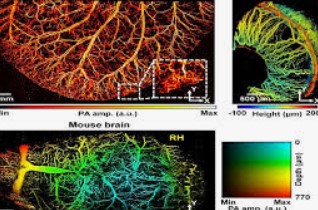 ejbi_inform's tweet photo. Researchers combine #photoacoustic and @fluorescence
imaging in tiny package. Read more at https://t.co/gHyiTTRWb1.
Submit your Research at https://t.co/RAuPNLJlTf
or email at editor@ejbi.org https://t.co/2rWJ60NN6G