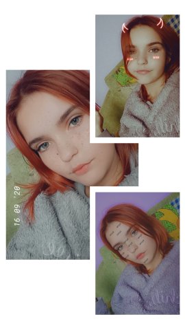 Я живой