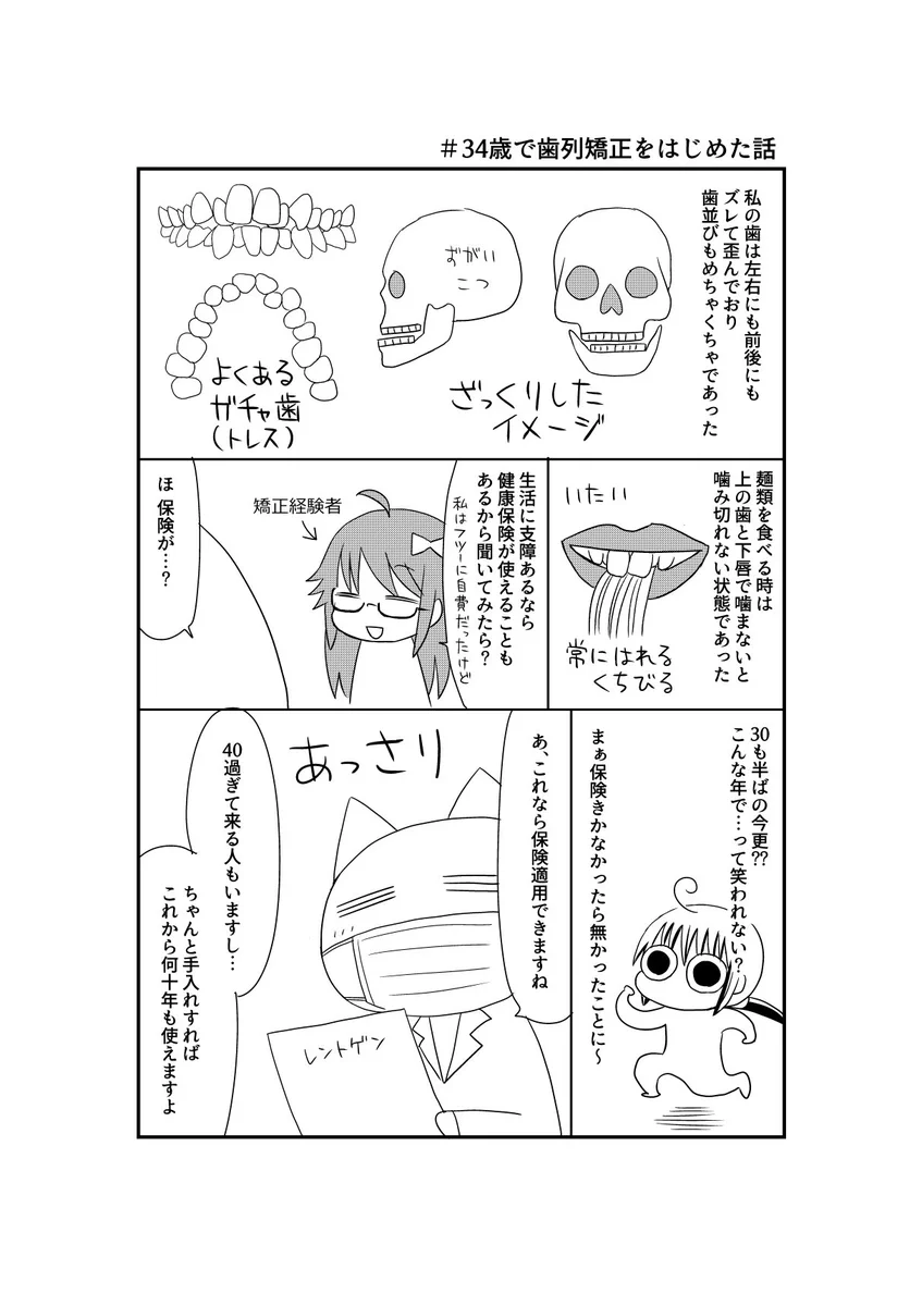 結論から言うと本当にやって良かった。34歳で「歯列矯正」をはじめてみた。