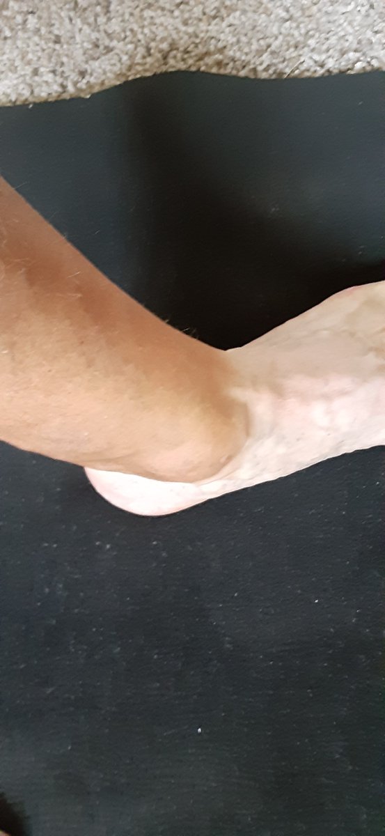 DanWucherer's tweet photo. The Retired Life 😊
Is this an extra sock, an albino foot, or a golf induced tan line? https://t.co/cbaPOjOaQQ