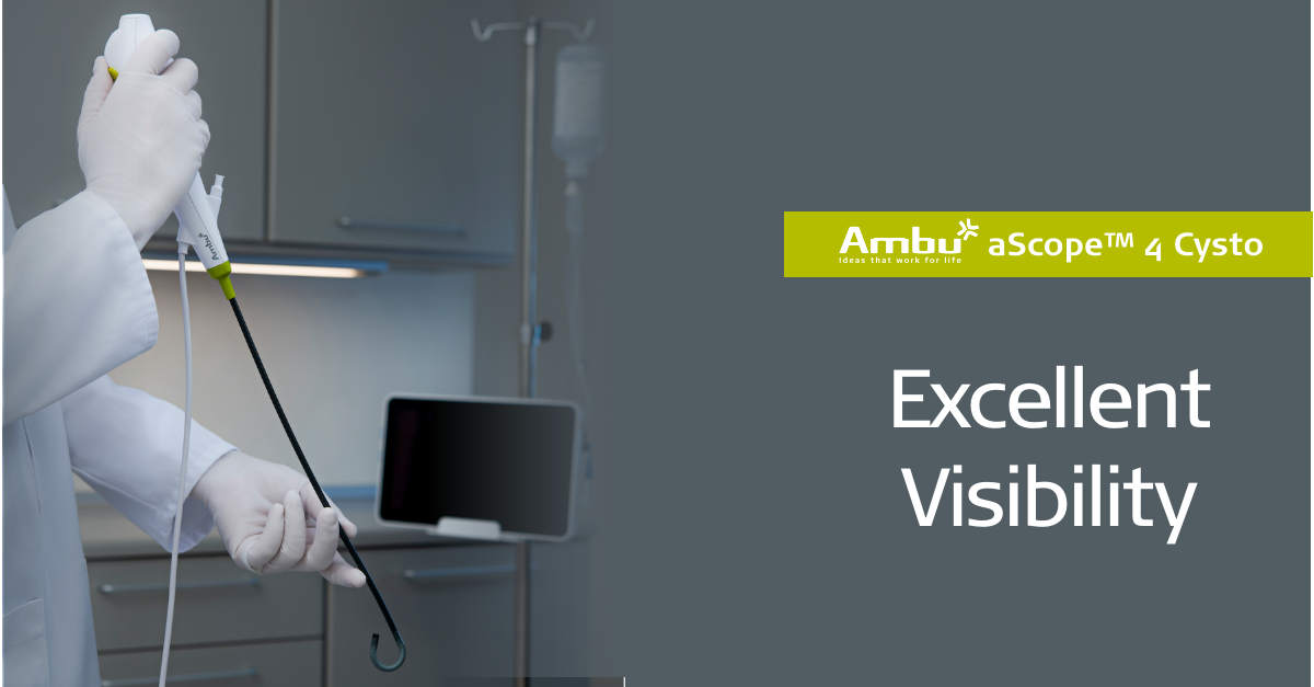 AmbuUSA's tweet photo. Dr. Yair Lotan says that “the aScope 4 disposable Cystoscope provides excellent visibility and maneuverability and can serve an important function in improving efficiency for urology practice.”
Want to see the aScope Cysto in action? Click the link below.
https://t.co/vKstWany8M https://t.co/PEVDrmUI5S