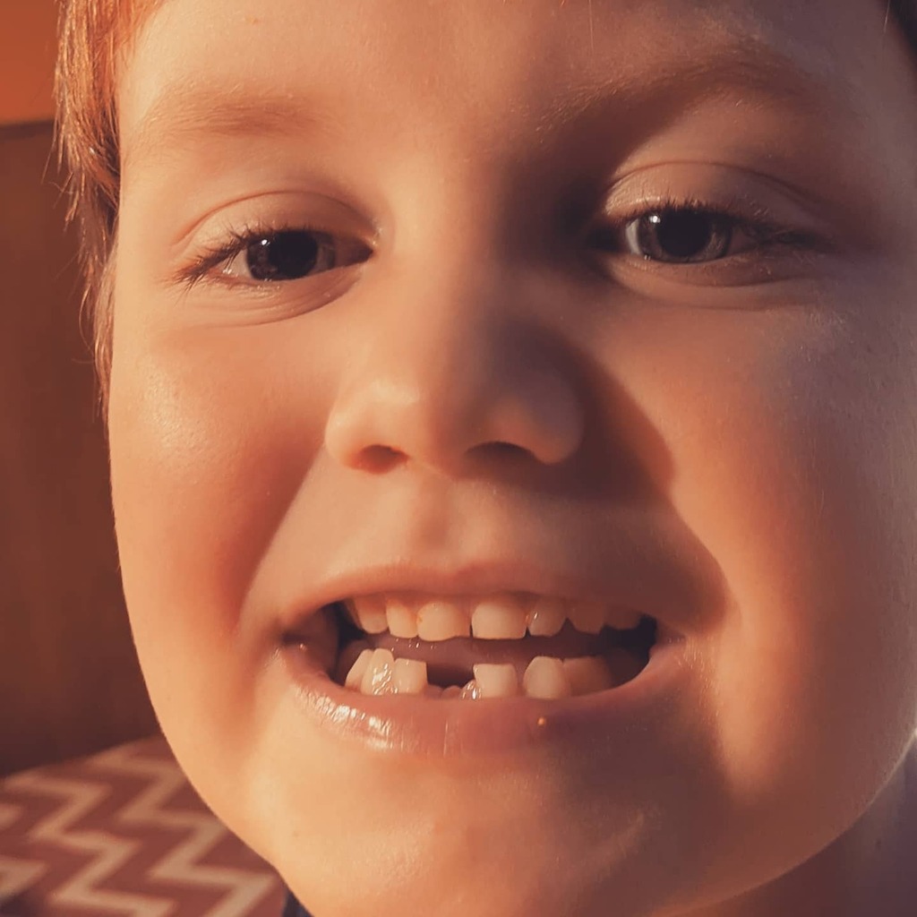 thelokey's tweet photo. So this happened earlier this morning. That baby tooth couldn't hold on any longer. #firsttoothlost https://t.co/QE5w1qyeUo