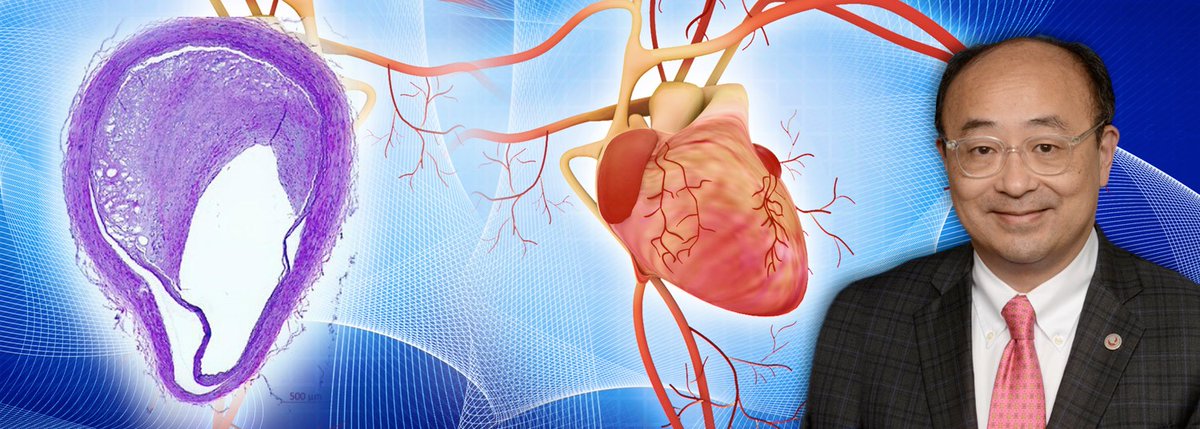 debkotz2's tweet photo. Having high LDL cholesterol in your teens/20's raises your risk of having a stroke/heart attack by middle age, even if you lower cholesterol in your 30's @UMmedschool @UM_Cardiology researchers find in compelling #JACC study. https://t.co/0uRGWKai1g https://t.co/G06Zr7he0N