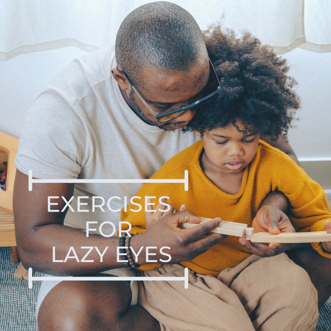 Lazy eye, or amblyopia, occurs in approximately 3 out of every 100 children, usually because one eye is stronger than the other. Over time, the brain stops receiving visual signals from the weaker eye. Exercises, although not enough to eliminate bit.ly/2FXRAIg