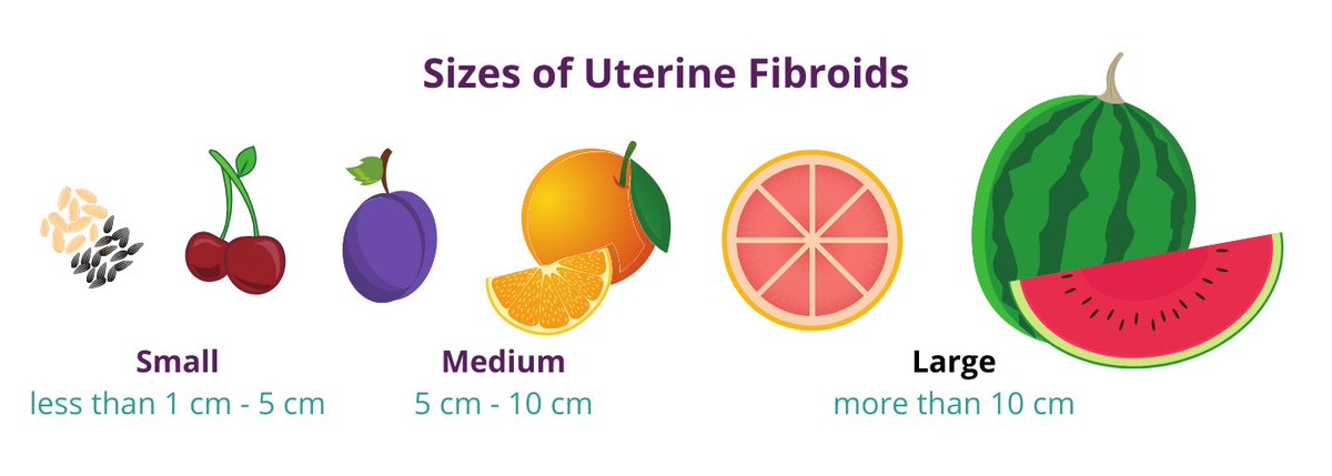 Get to know the type of fibroids by their location by clicking on the link here: usafibroidcenters.com/blog/visual-gu…

#uterinefibroids #uterine #doctors #doctorswhocare