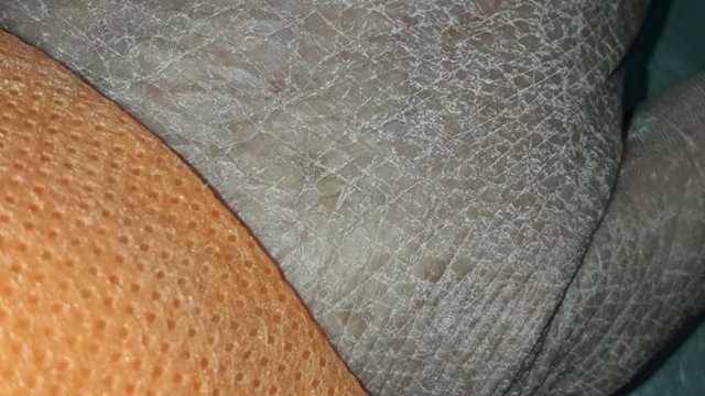 Cooperativa's tweet photo. [Fotos] Impactante imagen de mano de enfermera tras horas de trabajo se vuelve viral #CooperativaEnCasa https://t.co/UnFmc3jxya https://t.co/iSbQwFXZic