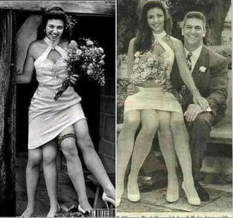 Hamza__UG's tweet photo. This woman was born with four legs.  Am here wondering in-between which legs is the thing located. 
#smashordie https://t.co/guYpCAgyQQ
