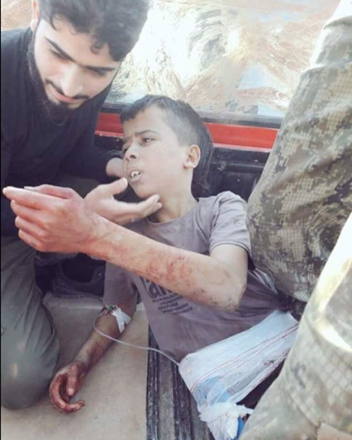They beheaded 19-year-old Syrian Arab Army soldier Abdullah al-Issa, who had thalassemia, a blood disorder that makes an adult look like a child.Al-Issa was kidnapped from a Syrian military hospital by Tulsi Gabbard's pal Assad and delivered to Zenki.