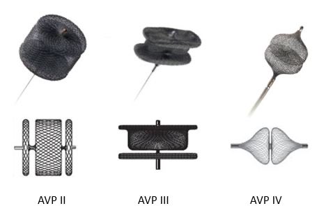 AVP II usually selected as it has 3 sections, and the middle lobe sits in the leak.