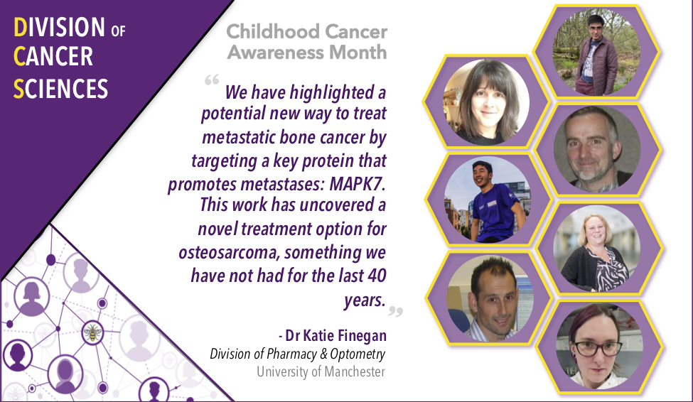 UoM_DCS's tweet image. Check out the amazing advances that @FineganLab and the team @OfficialUoM are making on treating #osteosarcomas, leading to ‘kinder’ treatments for children with #bonecancer, &amp;amp; saving lives! #ChildhoodCancerAwarenessMonth 

Read more here👇 

manchester.ac.uk/discover/news/… (1/3)