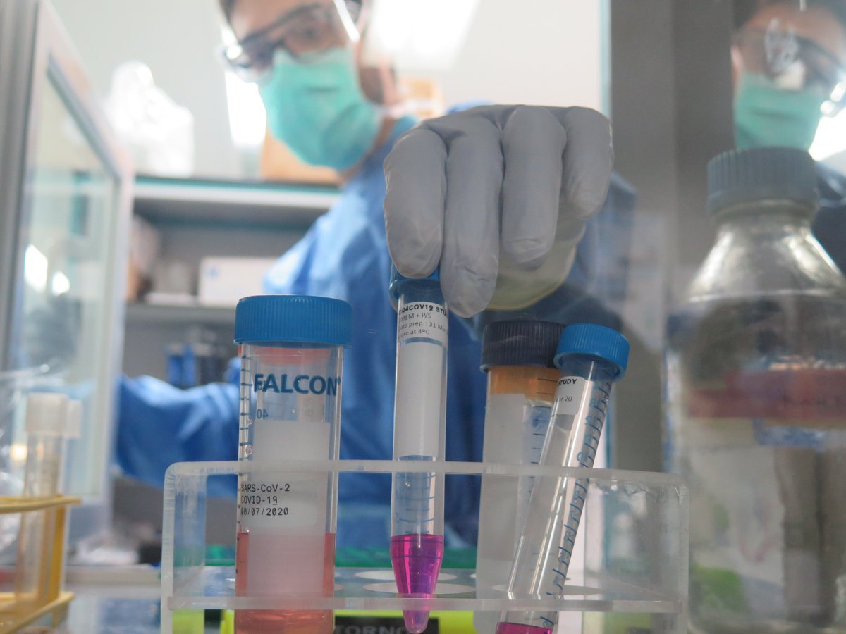 🛡️ Més del 10% de les persones amb infecció greu per #SARSCoV2 té #anticossos que boicotegen el seu propi sistema immunitari.

❎ Aquests anticossos bloquegen una molècula clau en la defensa del nostre cos contra el coronavirus: l'#interferó tipus 1.

👉🏾 bit.ly/340TrnI