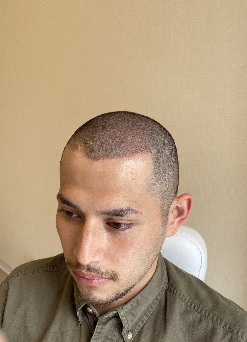 うお イケメンが顔出しでヘアタトゥーを紹介してる うお イケメンが顔出しでヘアタトゥーを紹介してる