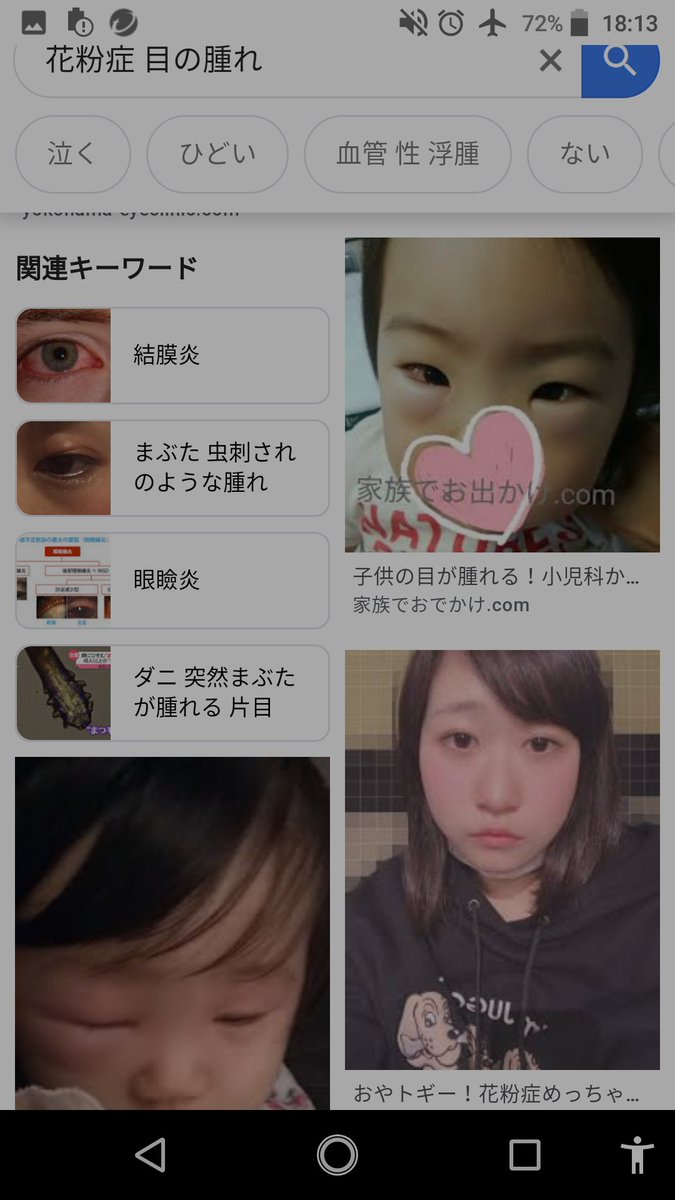 はっぱちゃん 花粉症 目の腫れ でググって写真見てたら見覚えのある写真が ん トギー トギーちゃん トギー Bis