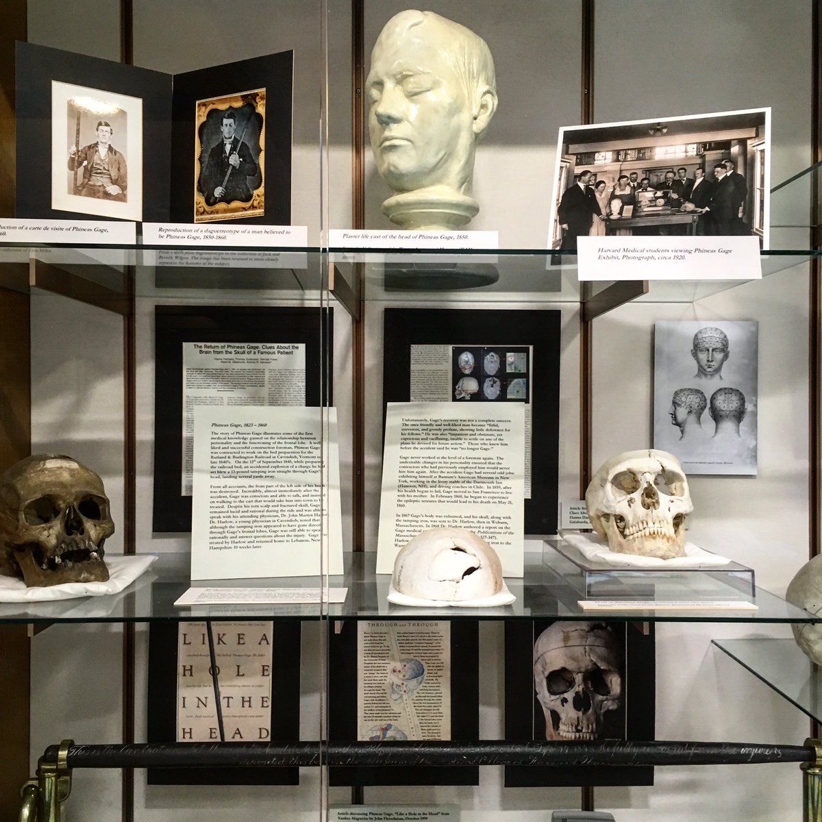 The skull and tamping iron of Phineas Gage. Alas, none of the exhibits of the Warren Anatomical Museum is currently on public display owing to renovations 