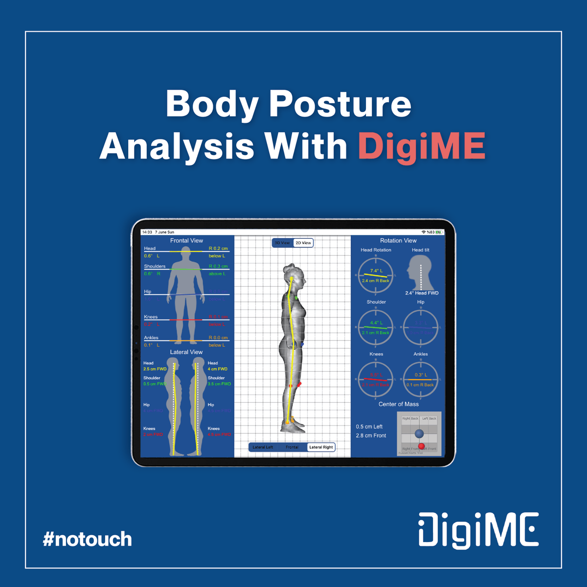 Digime3D's tweet photo. With posture analysis, you can learn how your body adapts to your lifestyle.
.
#digiME #healthtech #health #scan #DigiSports #DigiME #DigiMotion #DigiSize #DigiClinic https://t.co/r1XA0w1kSh