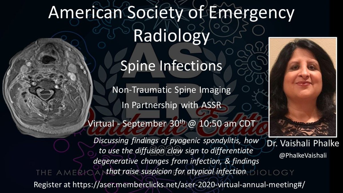 ERadSociety's tweet photo. Don't miss this amazing review of spine infections by Dr. Vaishali Phalke @PhalkeVaishali at Virtual #ASER2020! #Medtwitter #pandemiclife #RadRes

👉 If you haven't registered, it's not too late! 👈 https://t.co/7zMxYFJugB