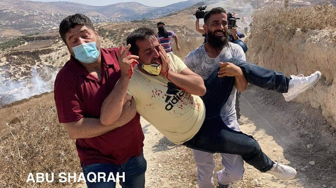 AyaIsleemEn's tweet photo. 🇵🇸#Palestine || Palestinians carry a young man who was injured after being hit by by tear gas canister in the face during the clashes with Israeli occupation and settlers in Asira village near Nablus. https://t.co/9aSCeNngDd