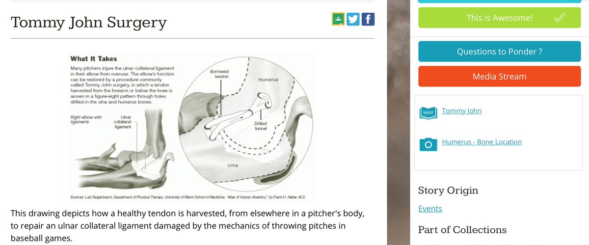Tommy John thinks his major-league baseball career is over when he ruptures his ulnar collateral ligament (UCL). But Dr. Frank Jobe restores him to pitching condition by performing a new type of surgery which is now commonplace. awesomestories.com/asset/view/Tom… <a href="/ramsgate2323/">skip nagelvoort</a> <a href="/aslore/">Jim Bos</a>