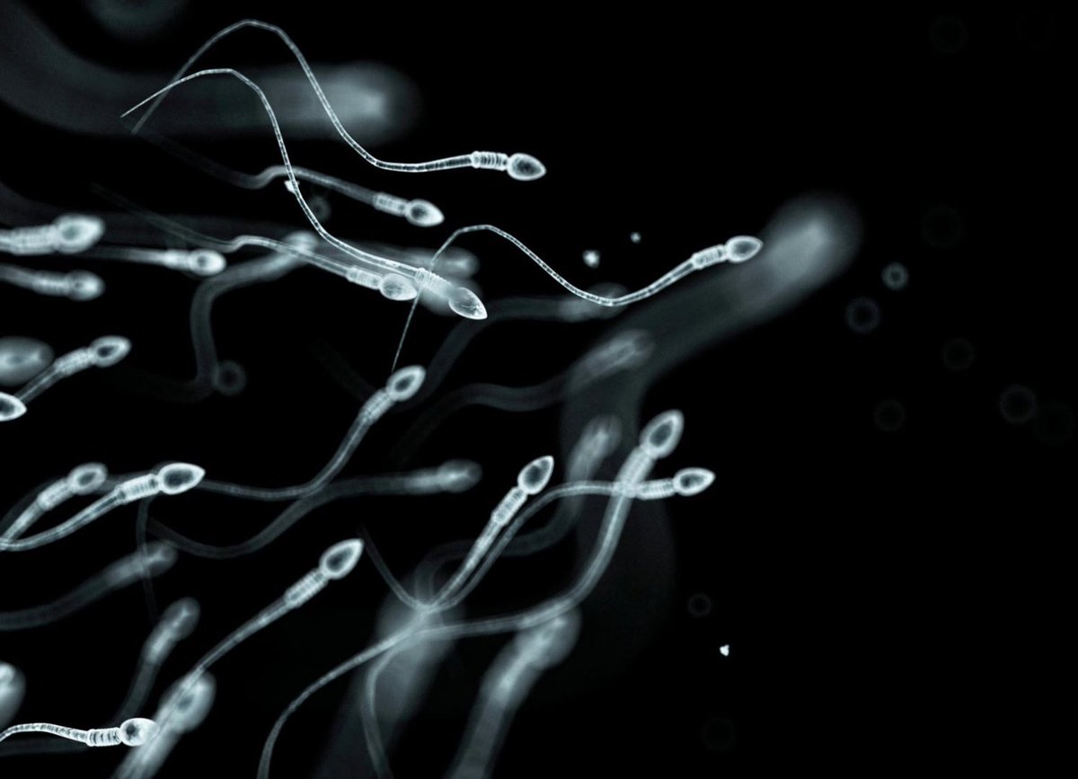The #testicles normally make around 1500 #sperm per second, and a single ejaculate contains between 30 and 500 million sperm! That’s a lot of fertilizing power. See a SSMR Urologist to assess your #malefertility potential. #malefactorinfertility #fertilityfriday