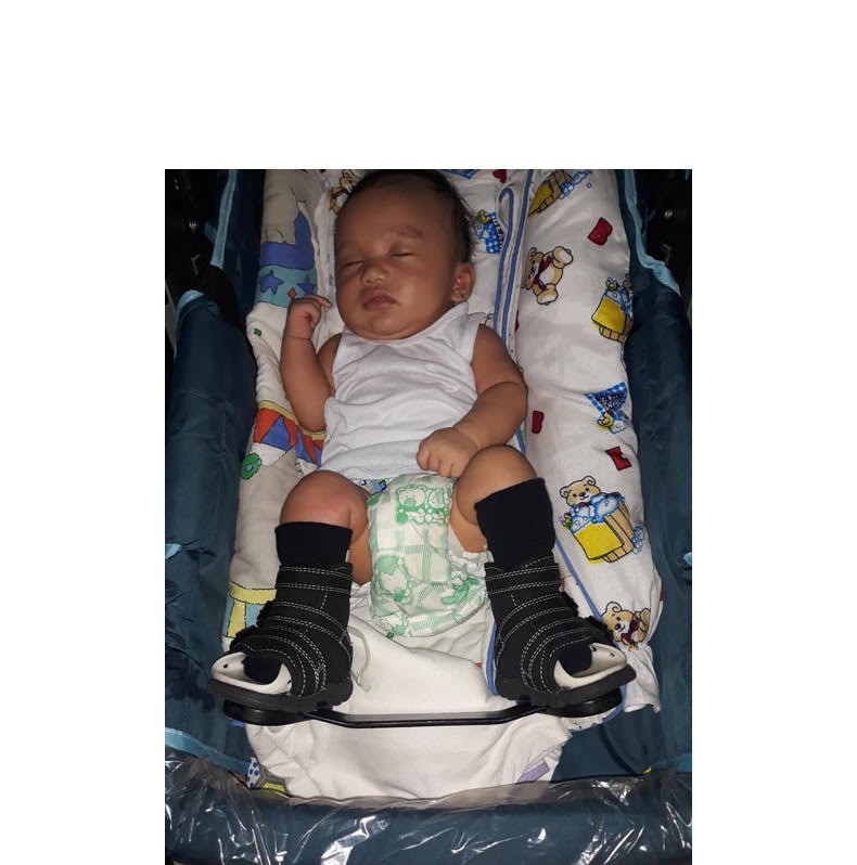 IowaBrace's tweet photo. This week's Clubfoot cutie is showing off their Iowa Brace in the Philippines If you want your cutie featured as the next Clubfoot cutie of the week, DM us a picture of them in their Iowa Brace! 👣 

#ClubfootCutie #Ponseti #ClubfootSolutions #Clubfoot #IowaBrace #Philippines https://t.co/ZcMCMC8Lie