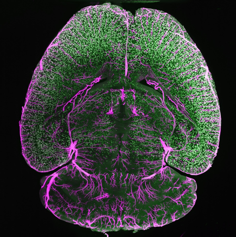 Photometrics's tweet photo. Today #fluorescencefriday presents a stunning iDISCO-cleared mouse brain taken with the #Iris15 on the #mesoSPIM #lightsheet, showing Aβ plaques (green) and arteries (magenta), courtesy of Dr. Fabian Voigt @mesoSPIM of the @FritjofHelmchen group of @UZH_en @UZH_Science! https://t.co/cjlr8uUazP