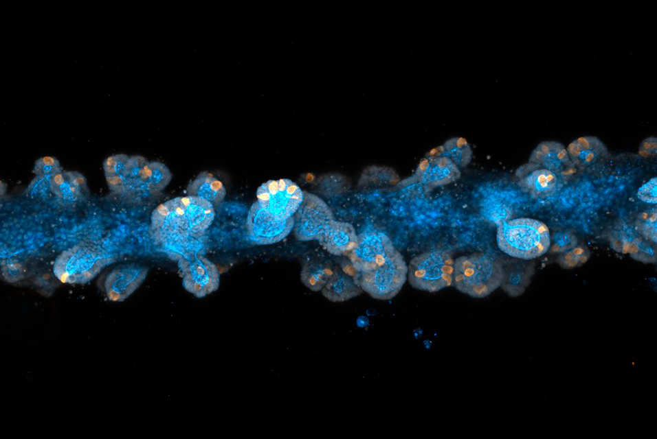 artdaily's tweet image. ArtDaily recommends: 
Researchers develop new method to print tiny, functional organs #researchers #newmethod #tiny #organs #science #newspaper

Read more about this here: ow.ly/YPQN50BBrdz