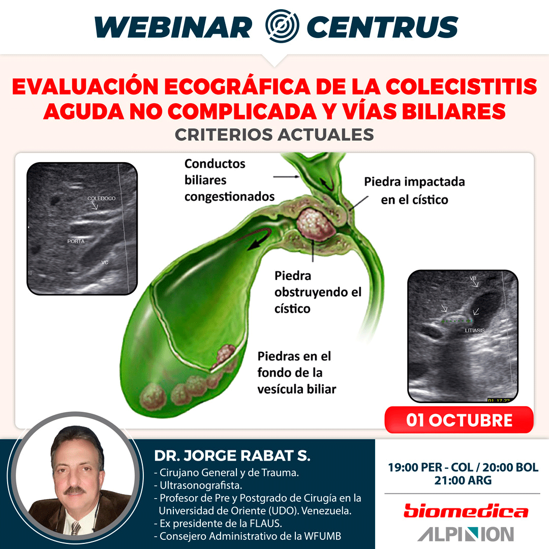 escuelacentrus's tweet photo. #WEBINAR CENTRUS
Evaluación ecográfica de la colecistitis aguda no complicada y vías biliares. Criterios Actuales.
✔️ Ponente: Dr. Jorge Rabat S.
✔️ Registrese en: https://t.co/OZXtAz989h https://t.co/znlxUwyy9C